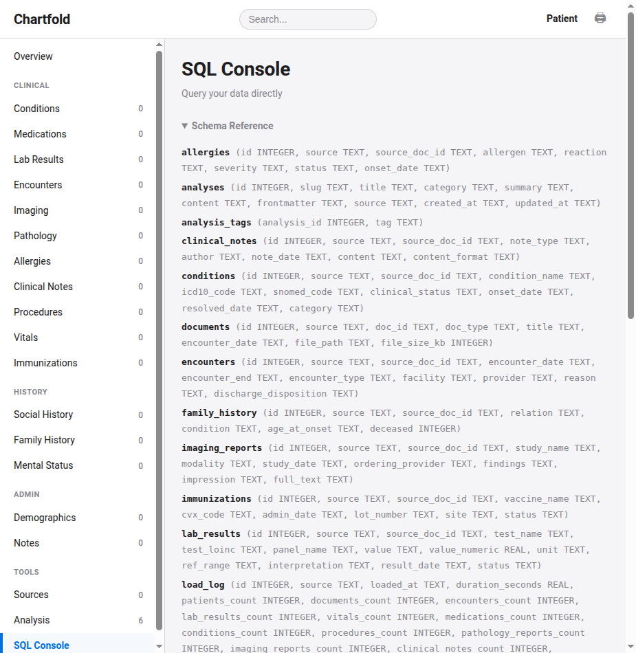 SQL Console showing the database schema